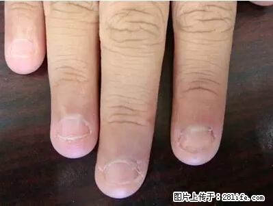 剪指甲、挖耳屎，这些日常小动作竟隐藏大危害！ - 日照生活资讯 - 日照28生活网 rizhao.28life.net
